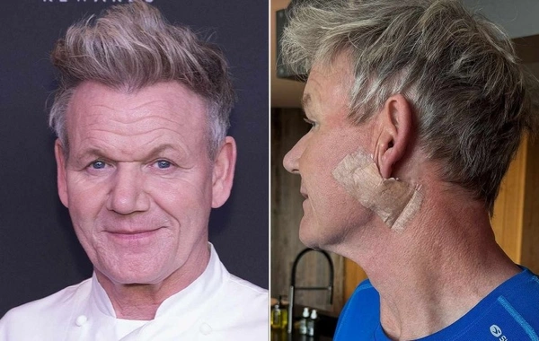 Famous chef battles the deadliest type of cancer