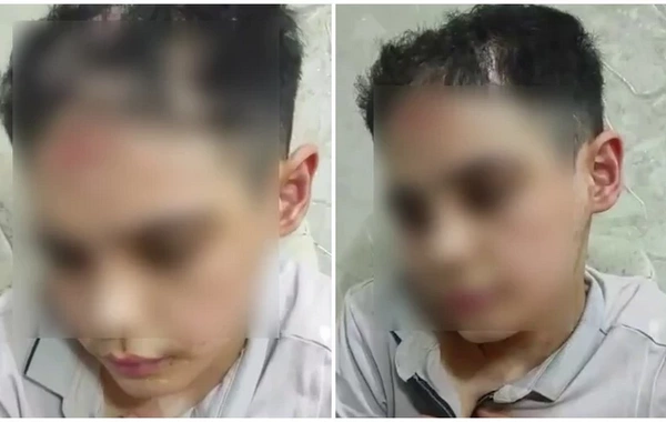 The 14-year-old Umid who was subjected to torture has been placed in a medical facility