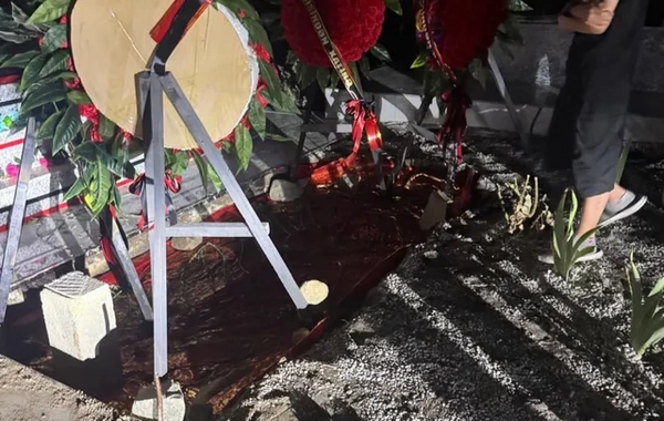 Bakıda rinoplastika əməliyyatından sonra iflic olan 34 yaşlı qadın öldü