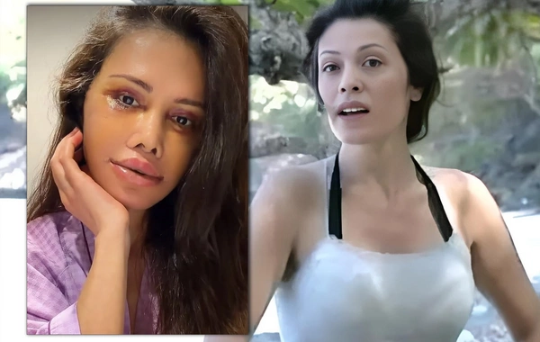 Keçmiş Survivor iştirakçısı üz nəqli əməliyyatı keçirdi