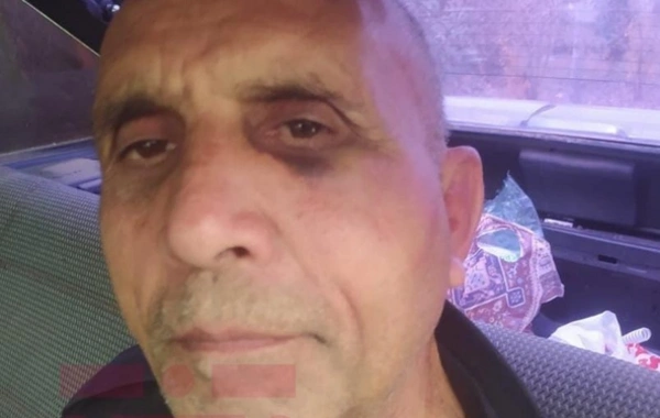 Psixiatriya Xəstəxanasında pasiyent döyülüb? - Polis araşdırmalara BAŞLADI