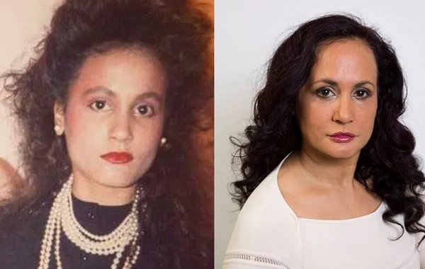 Üz dərisi qırışmasın deyə 49 ildir gülmür