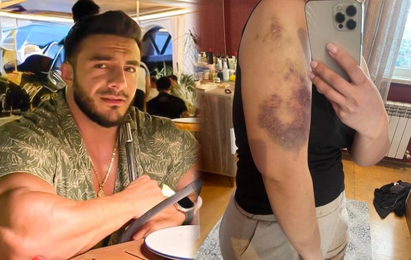 Accusations from ex-girlfriend against well-known fitness trainer: "He took 550,000 manats from me and beat me