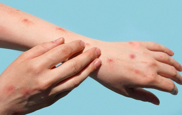 Смертельный вирус обнаружен в двух новых странах: мир в опасности