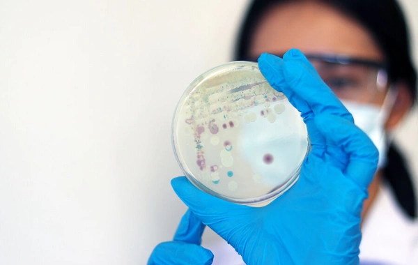 Ученые выяснили, какой грибок переживет путешествие на Марс