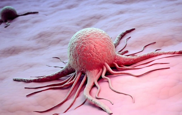 What types of cancer can alcohol cause? - A doctor explains