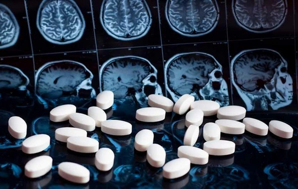 Sağlamlıq göstəriciləri alzheimer xəstəliyi ilə necə bağlıdır?