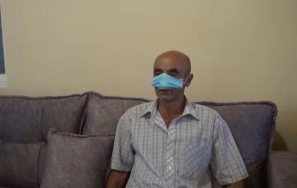 İt dişləməsi nəticəsində burnunu itirən pasiyent üzərində əməliyyat uğurla icra olunub