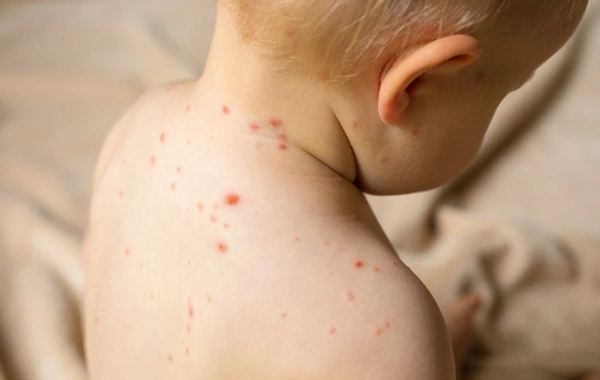 Su çiçəyi yenidən yayılır - XƏBƏRDARLIQ