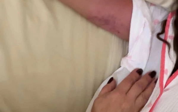 Bacısı Dilan Polatı döydü