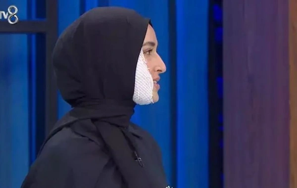 Üzünə qaynar yağ tökülən iştirakçı yenidən MasterChef Türkiyeyə qayıtdı