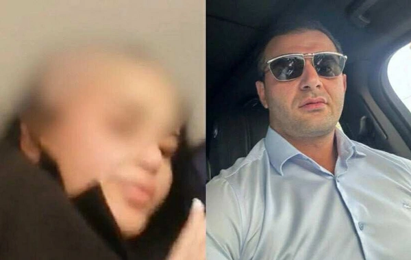 Həyat yoldaşının saçını keçəl edən ər HƏBS OLUNDU