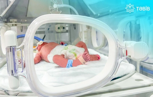 Ребёнка, родившегося в метро, отключили от аппарата искусственной вентиляции лёгких