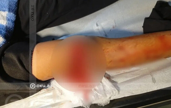 Bakıda VAZ-2107 11 yaşlı uşağı vurub qaçdı, polis yaxaladı