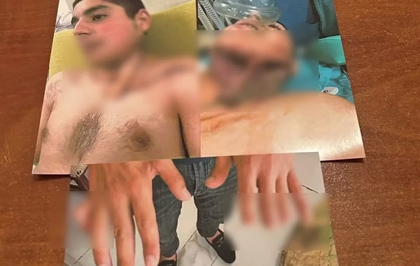 Əlillik ala bilməyən qazi ilə bağlı TƏBİB-dən açıqlama: Meyarlara uyğun deyil
