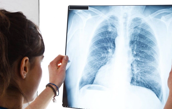 Депутат: Люди вынуждены ехать в Баку на рентген