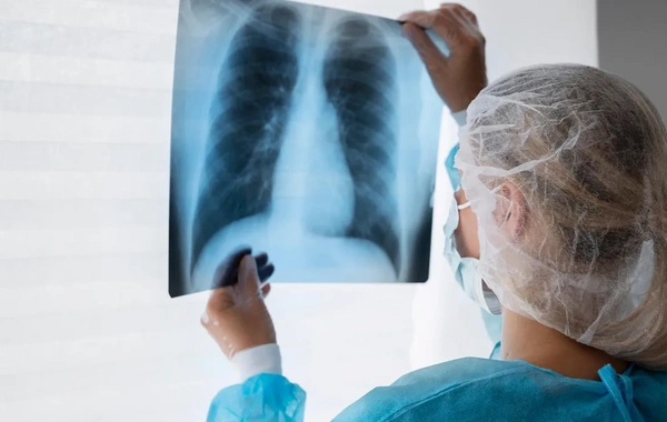 First case of incurable EVALI disease detected in Russia