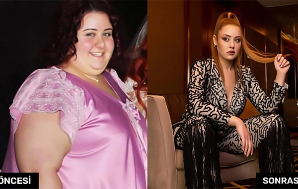 110 kiloqram arıqlayan aktrisanın SON HALI
