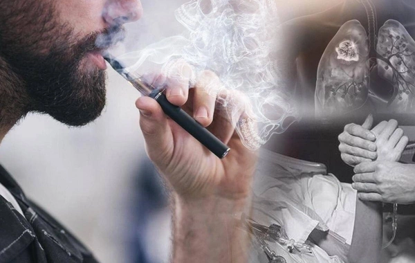 Qadağa elektron siqaret çəkənlərin sayını azaldıb? - VACİB AÇIQLAMA