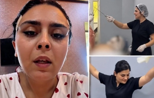 Daha bir nəfər rəqs edən həkimin qurbanı oldu