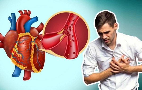 Мужчинам объяснили причины повышенного риска остановки сердца