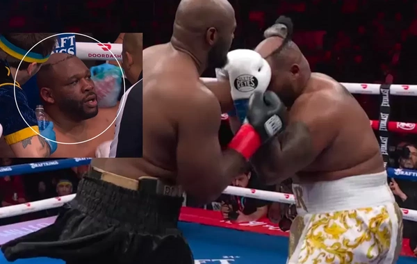 Nyu-Yorkda boks gecəsində yarışçının pariki ringdə düşdü