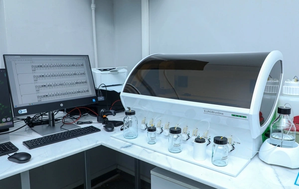 Mərkəzi Neftçilər Xəstəxanasında yeni autoimmun laboratoriyası istifadəyə verilib