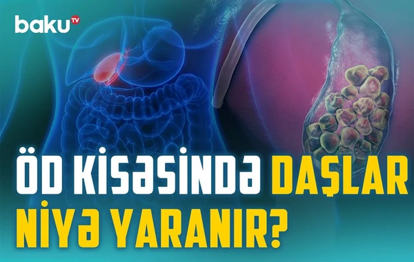 Öd və qaraciyər xəstəlikləri: Əməliyyat hansı halda şərtdir?