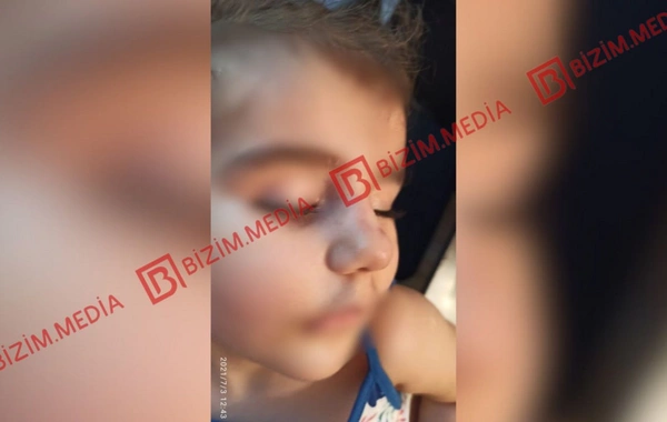 Lənkəranda qandonduran HADİSƏ – Ana isti qaşıqla 3 yaşlı qızının qolunu DAĞLADI