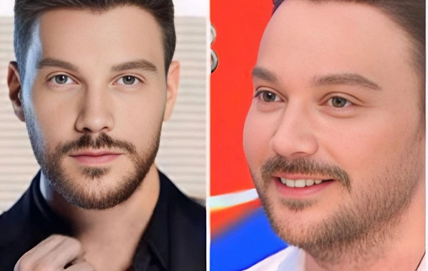 Sinan Akçıl estetik etdirmədiyini açıqladı