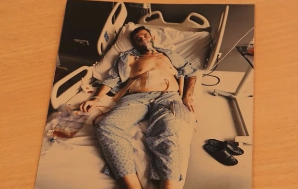 Təkrar mədəkiçiltmə əməliyyatı ciddi fəsadlar yaratdı