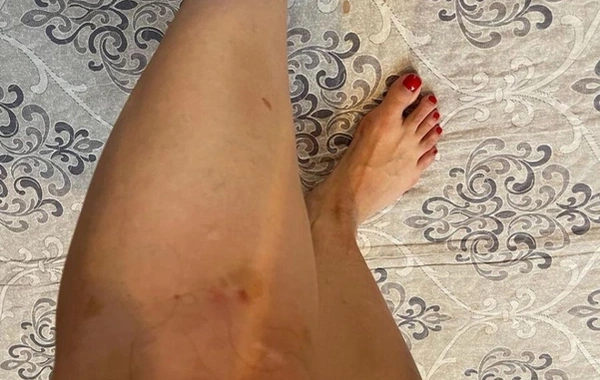 Keçmiş sevgilisindən tanınmış fitnesçiyə ittihamlar: "550 min manat pulumu ələ keçirib, məni dəfələrlə döyüb"