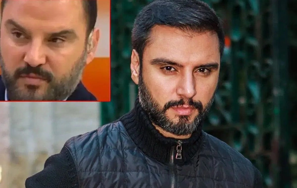 Alişan botoks etdirdiyini etiraf etdi