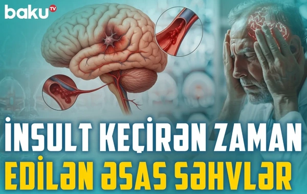Инсульт: как распознать первые признаки и спасти жизнь - Разъясняет специалист