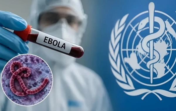Ebola tarixdə görünməmiş sürətlə yayılır: ÜST-dən HƏYƏCAN TƏBİLİ