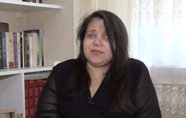 Gəncə terrorunda gözlərini itirən qadın başına gələnləri danışdı: "Qoymayın ölüm, qızlarım var"