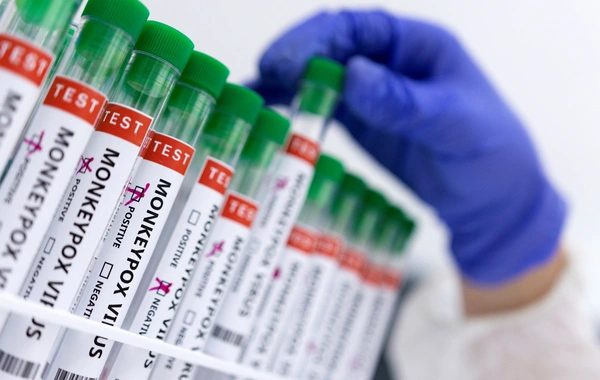 Первый случай опасного вируса в Азербайджане - Как от него защититься?