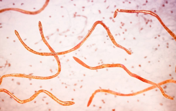 52 yaşlı supermodel bədənini qurd və parazitlərdən təmizlətdiyini ETİRAF ETDİ