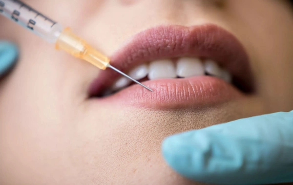 Bloggers are giving up fillers: is the fashion for perfect beauty becoming a thing of the past?