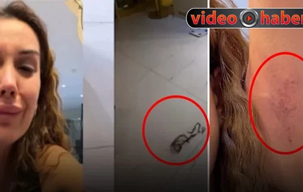 Bacısı Dilan Polatı döydü