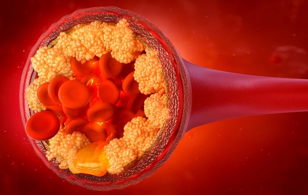A simple way to reduce the level of bad cholesterol in the blood has been named