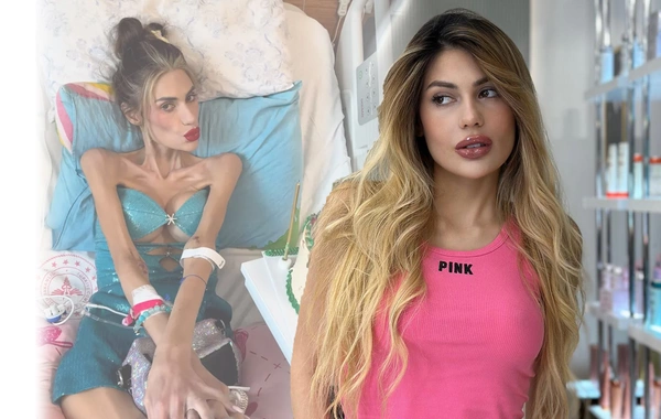 23 kiloqram olan Nihal Candanın orqanları fəaliyyətini dayandırıb