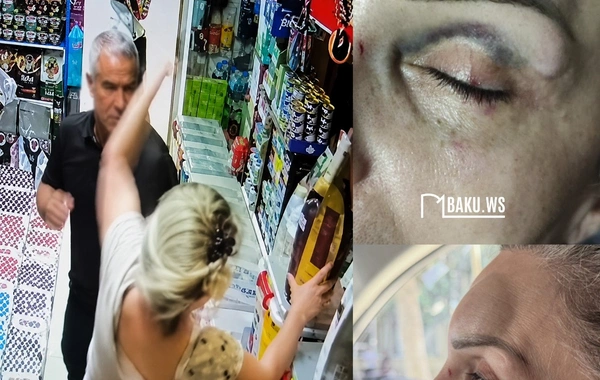 Bakıda mağazaya girib qadını yumruqlayan kişi HƏBS OLUNUB