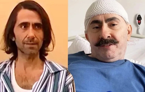 Beyninə qan sızan aktyorun SON HALI