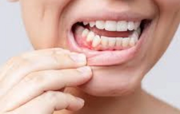 An unexpected link named between gum health and heart diseases