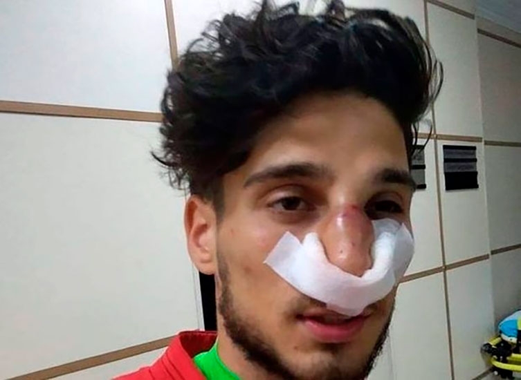 Mahir Mədətov qapıçının burnunu sındırdı