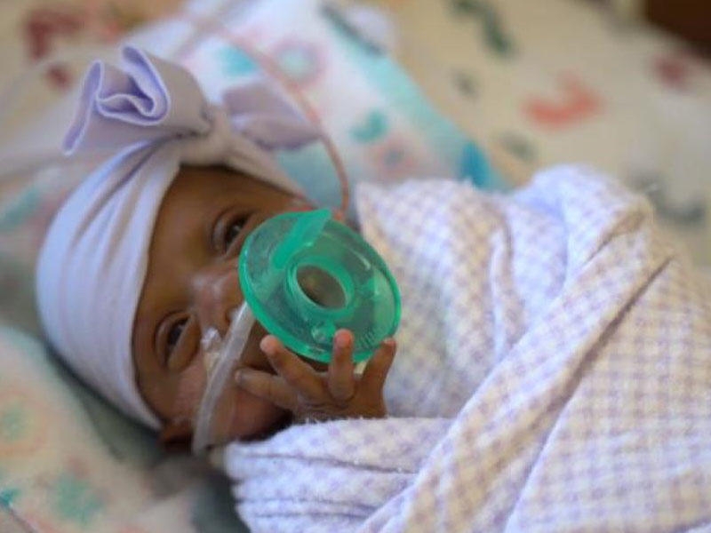 Dünyanın ən balaca körpəsi doğulub - ALMA BOYDADIR - FOTO