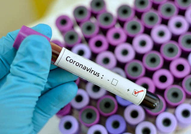 Gürcüstanda koronavirusa yoluxan azərbaycanlının vəziyyəti açıqlandı
