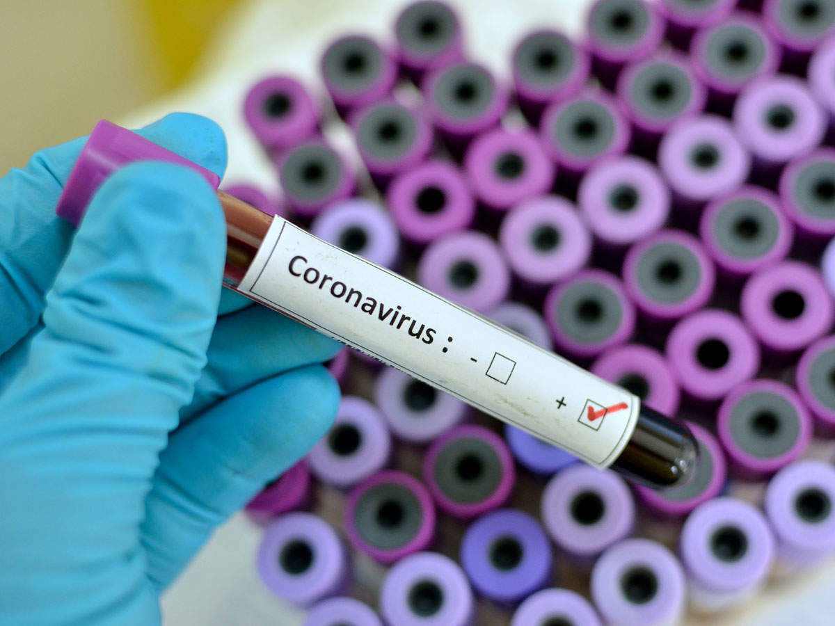 "Virus laboratoriyadan yayılıb" - Koronavirusun sonu barədə
