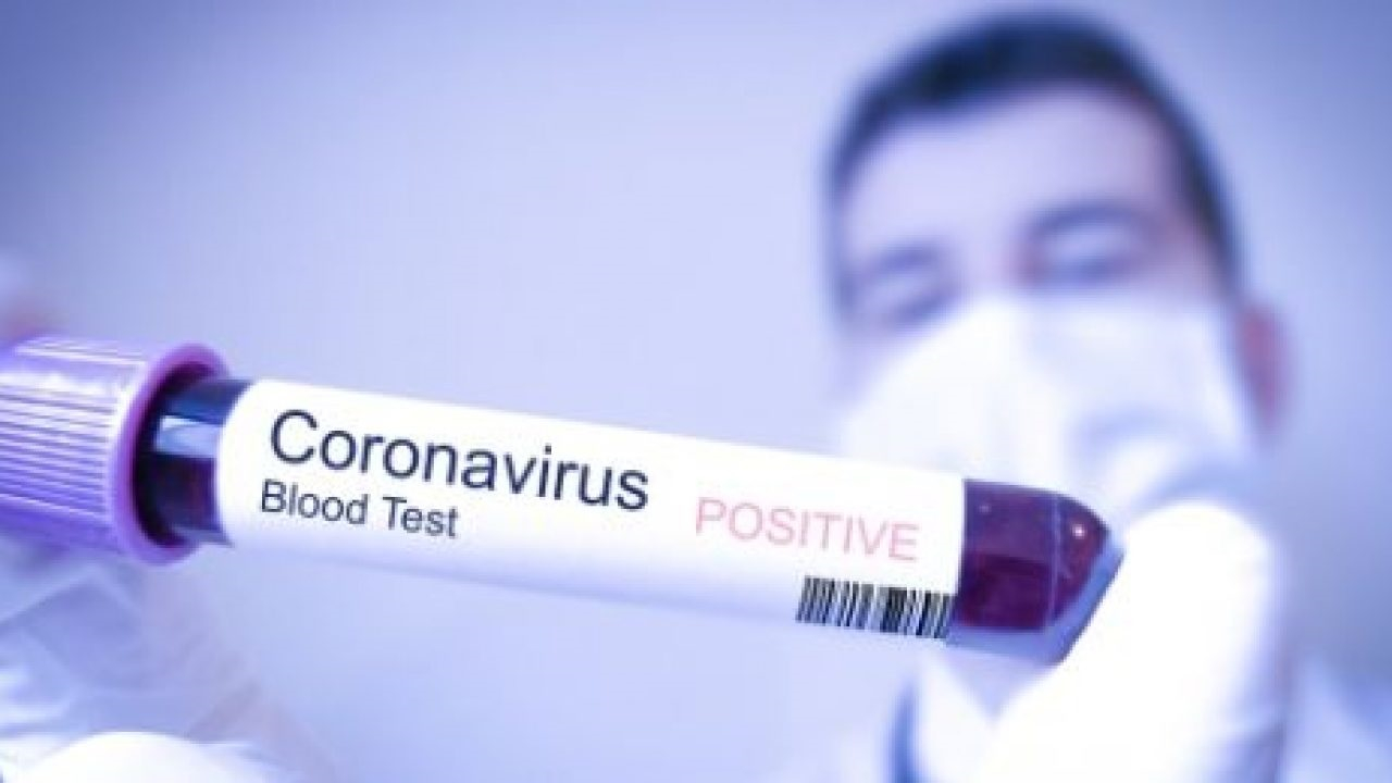 Koronavirus bu temperaturda aktiv qalır
